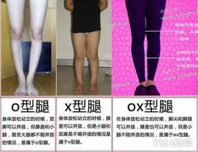 o型腿和x型腿真人图 o型腿和x型腿的体操矫正法